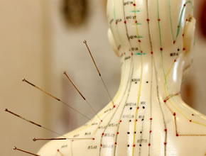 Akupunktur bei Dr.med.Kai-Uwe Schreiter